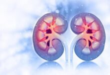 سلامت مغز با عملکرد کلیه مرتبط است - خبرگزاری مهر ایران و جهان