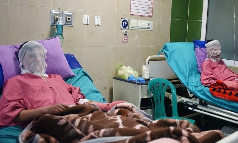 جای خالی تخت تخصصی سوختگی در بیمارستانهای دولتی