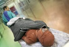 کمبود هزار تخت بیمارستانی سوختگی در کشور - خبرگزاری مهر ایران و جهان