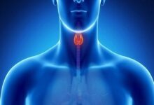 مراقب خرابی «پدال گاز» بدنه باشید - خبرگزاری مهر ایران و جهان