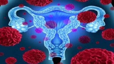 فیبروم رحم با خطر بیماری قلبی در زنان مرتبط است - خبرگزاری مهر ایران و جهان