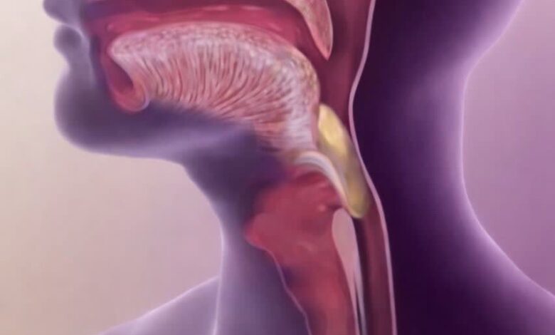 درمان اختلال بلع چیست؟