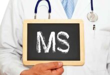 راه هایی برای افزایش تبعیت از درمان در بیماران ام اس برای کنترل بیماری و پیشگیری از ناتوانی های جدی