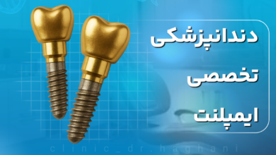 دندانپزشکی تخصصی ایمپلنت