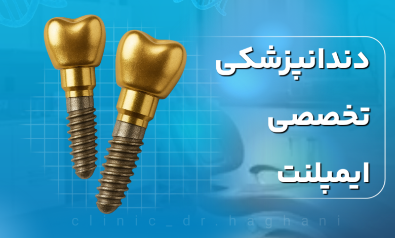 دندانپزشکی تخصصی ایمپلنت