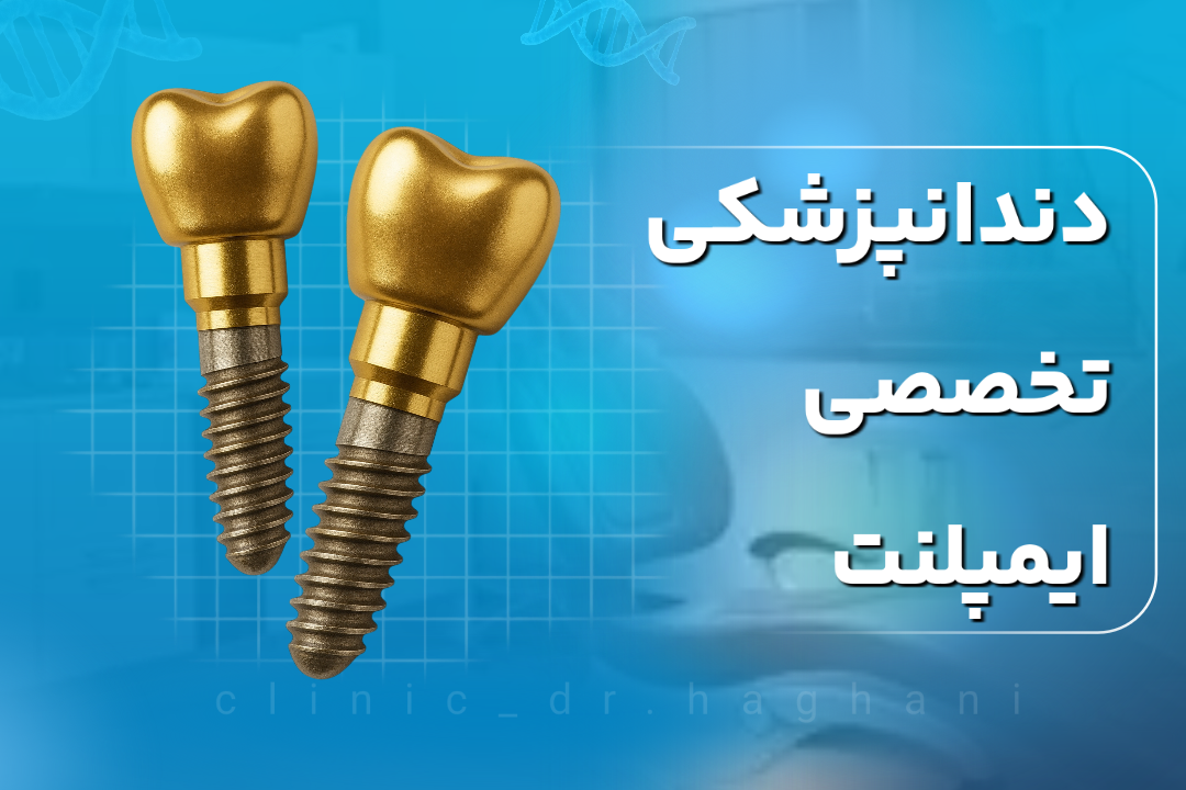 دندانپزشکی تخصصی ایمپلنت
