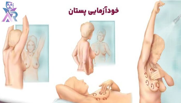 خودآزمایی پستان ها