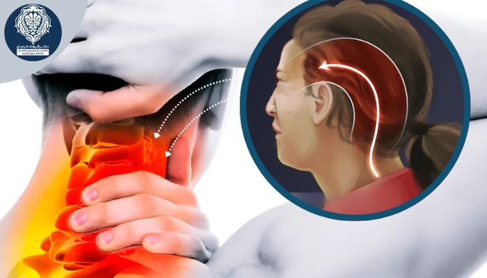 علائم سردرد ناشی از دیسک گردن