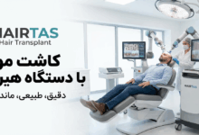 کاشت مو با دستگاه هیرتاس بهتر است یا روش FUT؟ (تحلیل تخصصی دو نسل از جراحی کاشت مو)