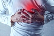 علائم بیماری های عروقی را بشناسید - خبرگزاری مهر ایران و جهان