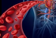 کدام غذاها برای بهبود سلامت رگ های خونی مفید هستند؟