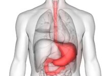 التهاب روده، خطر پوکی استخوان را افزایش می‌دهد