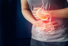 راه حل هایی برای تقویت و تسکین سوزش و درمان رفلاکس معده دمنوش های طب سنتی معده