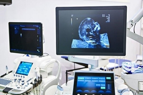 علائم هشدار دهنده سرطان زنان را نباید نادیده گرفت - خبرگزاری مهر ایران و جهان