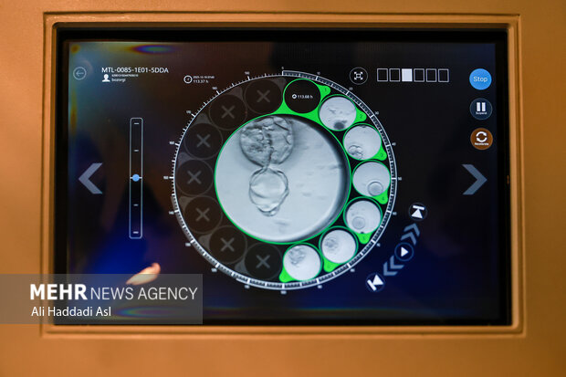 تأثیر مصرف سیگار و الکل بر موفقیت بارداری و IVF