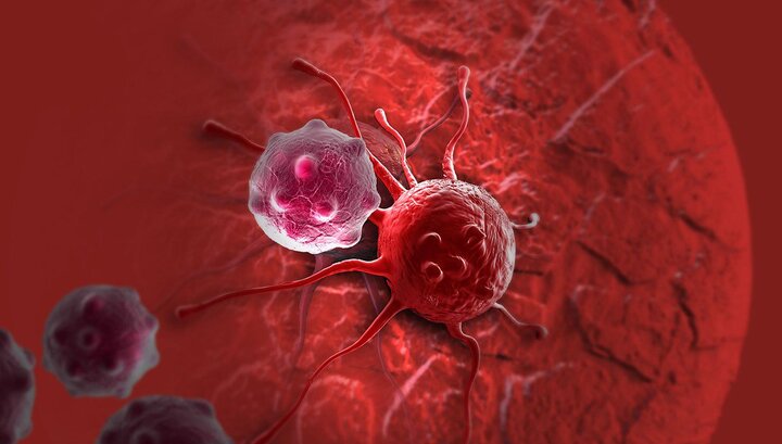 افزایش نگران کننده سرطان روده بزرگ در ایران