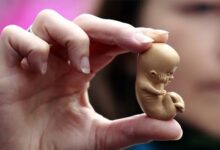 سه ضلع تهدید برای سلامت جنین و جان مادر