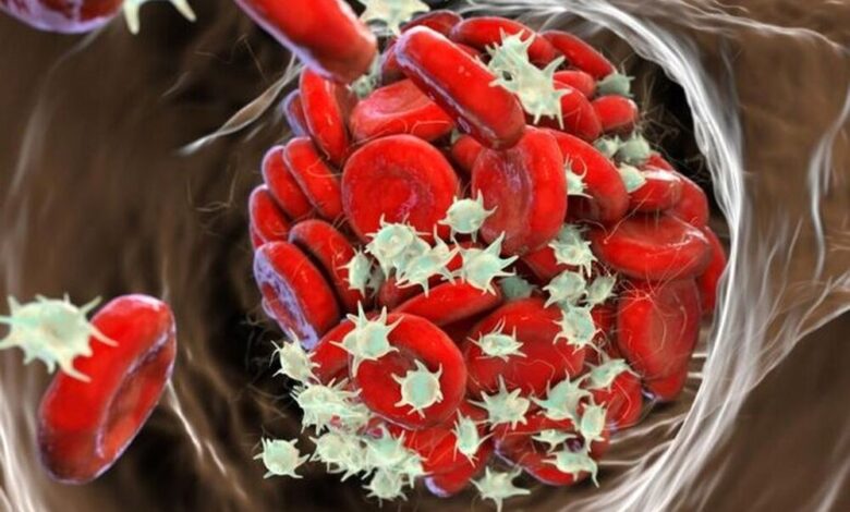 نتایج امیدوار کننده از استفاده از نسل جدید داروهای ضد انعقاد در کودکان