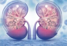 عملکرد کلیه ها در بدن چیست؟ | حجم بالای خون رسانی به کلیه ها