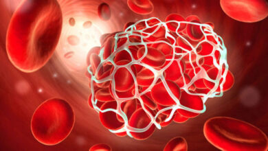 هشدار درباره خطر ماساژ پا برای بیماران مبتلا به لخته خون