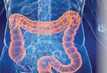 چگونه التهاب و کمبود آهن رانش پیری در روده را تسریع می‌کند؟