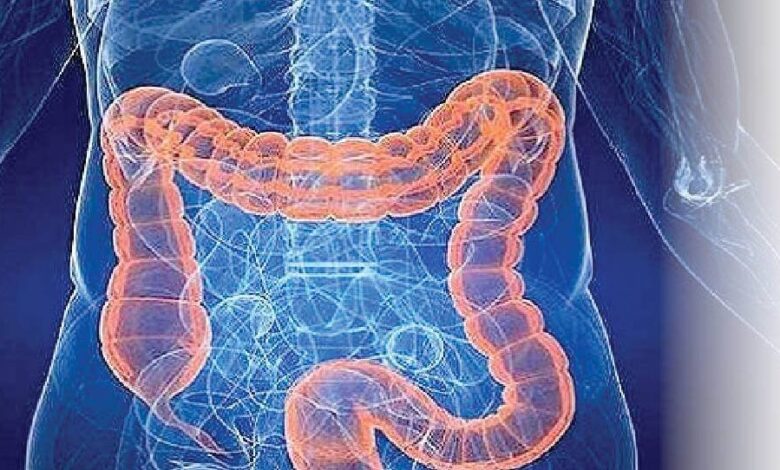 چگونه التهاب و کمبود آهن رانش پیری در روده را تسریع می‌کند؟