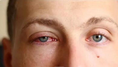 عفونت انگلی «آکانتامبا»؛ خطر تشخیص اشتباه و از دست رفتن دائم بینایی