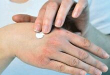 راهکارهای طب ایرانی برای حفظ سلامت پوست و بدن در فصل سرما - خبرگزاری مهر ایران و جهان