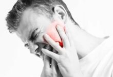 درد فک را جدی بگیرید - خبرگزاری مهر ایران و جهان