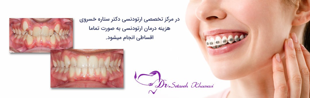 درمان ارتودنسی اقساطی _ دکتر ستاره خسروی