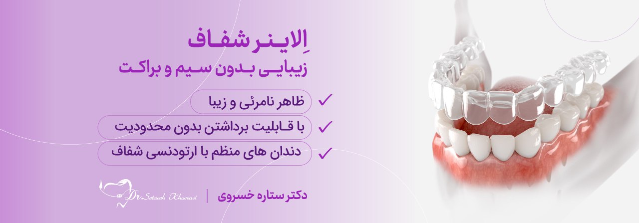 الاینر شفاف_ ارتودنسی نامرئی
