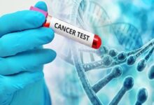 سبک زندگی فعال؛ سپر قدرتمند در برابر سرطان