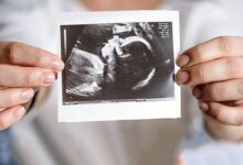 اهمیت تشخیص زودهنگام بیماری های قلبی در بارداری - خبرگزاری مهر ایران و جهان