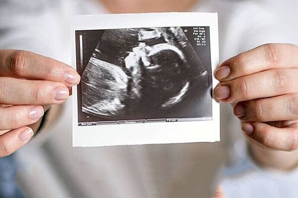 اهمیت تشخیص زودهنگام بیماری های قلبی در بارداری - خبرگزاری مهر ایران و جهان