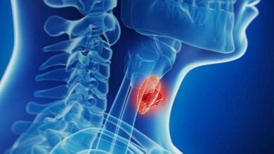 افزایش تشخیص بدخیمی های تیروئید - خبرگزاری مهر ایران و جهان