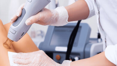 لیزر موهای زائد روی پوست آسیب دیده