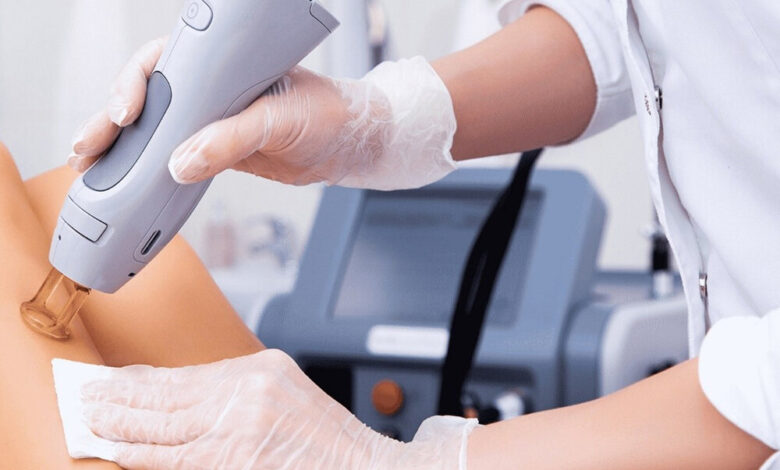 لیزر موهای زائد روی پوست آسیب دیده