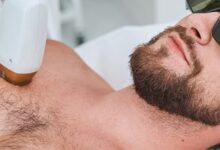 روش های جدید لیزر موهای زائد