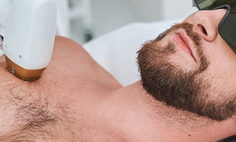 روش های جدید لیزر موهای زائد