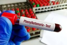 خبر خوب برای بیماران PKU؛ توزیع نان بدون پروتئین - خبرگزاری مهر ایران و جهان