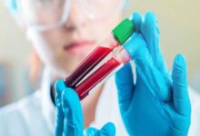 احتمال ابتلا به سرطان چقدر است - خبرگزاری مهر ایران و جهان