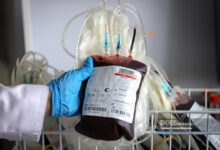 کاهش عوارض انتقال خون با توسعه خون فقیر از لکوسیت / پیشرفت در سازمان انتقال خون پس از انقلاب