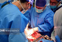 چه کسانی بیشتر در معرض خطر تومورهای مغزی هستند - خبرگزاری مهر | اخبار ایران و جهان