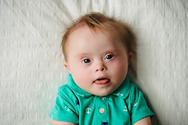 الکل در بارداری؛ خطری که با هیچ درمانی قابل جبران نیست