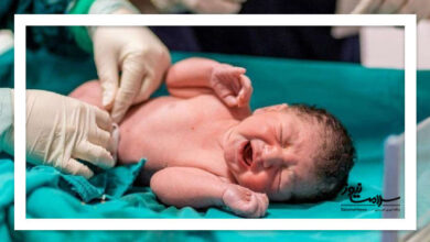 بررسی علل عدم تمایل مادران به تکرار زایمان بی‌درد
