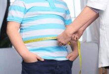 ابتلای دو سوم بزرگسالان به چاقی در کشور