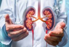 کلید پیشگیری از بیماری مزمن کلیوی - خبرگزاری مهر ایران و جهان