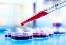 آزمایش خون می تواند بیماری کرون را پیش بینی کند - خبرگزاری مهر | اخبار ایران و جهان