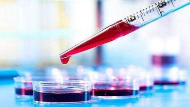 آزمایش خون می تواند بیماری کرون را پیش بینی کند - خبرگزاری مهر | اخبار ایران و جهان