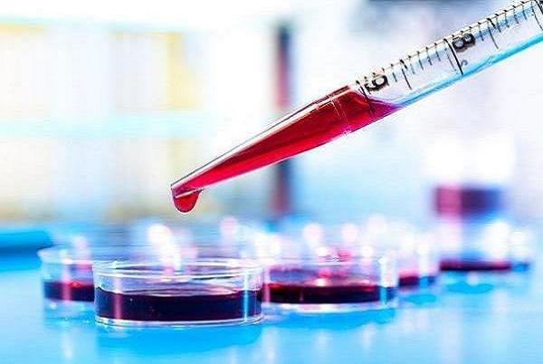 آزمایش خون می تواند بیماری کرون را پیش بینی کند - خبرگزاری مهر | اخبار ایران و جهان